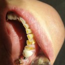 김준천치과의원 | 의정부 민락동 치과 임플란트 추천, 김준천 치과의원