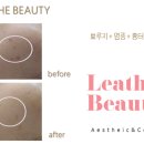 샵아떼 | 오산 피부샵 르아떼뷰티 | 뾰루지 염증 흉터 관리 후기