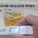 여성 암 사망률 1위 ‘난소암’, 특히 조심해야 할 사람은? 이미지