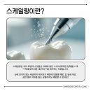 신세계치과의원 | 경성대 스케일링 비용, 주기, 보험 적용까지! 신세계치과가 알려드려요