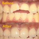 메디포레치과의원 이미지