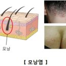 서은옥피부과 네이버블로그