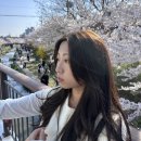일중 | 이마 필러 재시술 후기 | 8개월동안 이마필러만 3번 맞은 사람