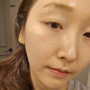 프리스틴의원 네이버블로그