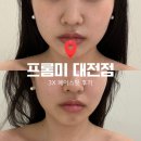 씨제이메디컬 | 윤곽 리프팅부터 피부 탄력까지 한 번에, 대전 유성구 프롬미 에스테틱 3X 페이스핏 관리 후기