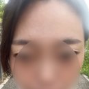 베네핏의원 | 분당 미금역 베네핏의원/ 진우패치 후기 실비보험가능!!