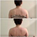 라피엘 | 인천 송도 승모근관리 가성비 좋은 라피엘 추천 후기