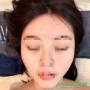 아현 - 해운대구 선수촌로 8-8 | {찐찐 아현피부관리 후기} 꼼꼼한 신촌피부관리 후기! 신촌에스테틱 ‘라르본뷰티’