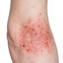 안산한의원 이미지