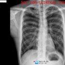 하나이비인후과병원 이미지