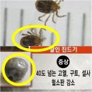 살인진드기 국내발견 살인진드기 증상 살인진드기 예방방법 이미지