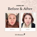 광림메디칼 | 부산 남천동 에스테틱 진정관리 | 베테랑 손길이 다른 단아한에스테틱 솔직 리뷰