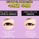 미호성형외과의원 이미지