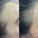 장헤어라인 - 아산시 | 장헤어라인