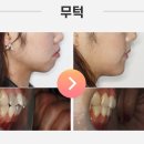 바른웅치과의원 이미지