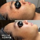 스킨바이블