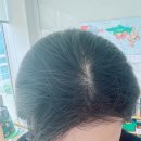 지유루원 | [에코레비 헤어앤스파 루원시티점] 복구클리닉 후기