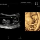 (주)건형 | 또다른 도파민 등장