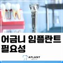 에이플란트치과의원 네이버블로그