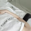 이든핏 | [목포 LDM 물방울 수분관리 추천] 목포 이든에스테틱 아크핏비상라인 LDM 물방울 수분관리 후기