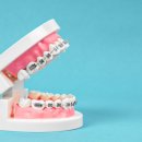 환한미소 바른이치과의원 이미지