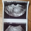 버디모텔 | D.8 - 임신 근로시간단축 신청(4주2일~5주1일)