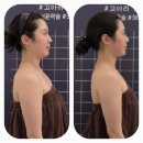 내돈내산 :: 전주 만성동 [고아라컨투어샵] JH윤곽술 걸그룹관리 윤곽관리 작은얼굴관리 후기