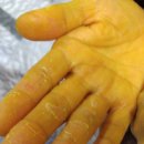 퀀텀의료기 이미지