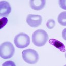 중3-372 L 이미지