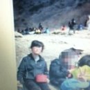 민들레안과의원 | 초고도근시의 ICL/렌즈삽입수술 검사와 예약 : 대전삼성스마일안과] 25년 중 19년을 안경과 함께한 인생..