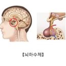 말단비대증 거인증 원인, 뇌하수체 종양 및 이미지