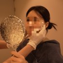 와이디의원 | [와이디의원] 피부 얇으면 무조건 써마지? 올타이트 원리부터 확실하게 정리해 드립니다.