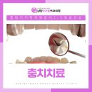 남양선연합치과의원 네이버블로그