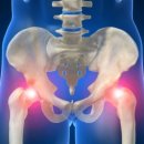 가온체형교정운동센터 이미지