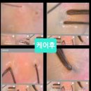 감탄헤드스파 두피클리닉