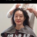 풍성풍성두피