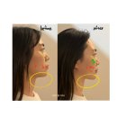 아름다울유 | 의정부 신부관리 , 아름다울유 윤곽관리 후기