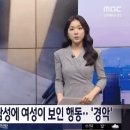 (말레이시아)엘리베이터에서 만난 다운증후군 남성에게 뜨거운물 부은 여자 이미지