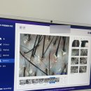 구월119안전센터 | 인천탈모 [모바이오 구월본점] 두피 스케일링 만족 후기