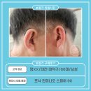 오티콘보청기대전대덕점 | 대전 대덕구 보청기,정XX 고객님 포낙 오데오 인피니오 스피어 90 구매후기(60대,男)