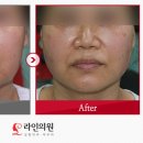 티나성형외과의원 이미지