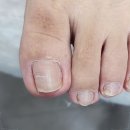 반송동210 | 동탄 반송동 내성발톱 발각질관리 네일포유에서 함께 병행