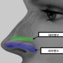 비밸브재건술 이미지