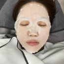 벤스 | 홍대 벤스의원 온다리프팅 솔직 후기정확한 피부진단 + 턱선 리프팅 집중 시술 받았어요!