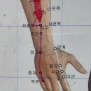 11.8~10질의응답 : 중풍, 발가락뼈골절, 산후병증 등 이미지