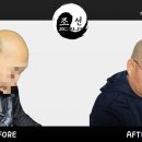 조선스칼프 이미지