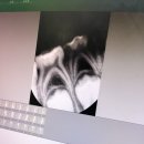 수완더치과병원 네이버블로그
