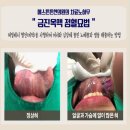 에스튼튼한의원 이미지