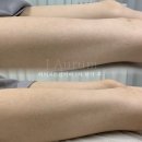 제이아우룸&스킨52 | 제이아우룸 스킨52 튼살커버 할인이벤트! 무려 50%OFF