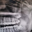 하이치과의원 이미지